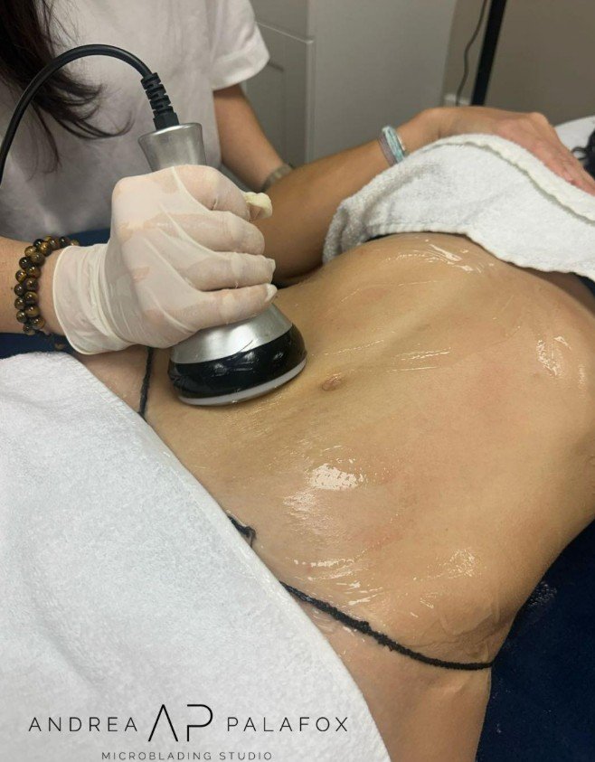 Cavitacion ap microblading